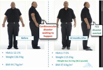 Cardiovascular Benefit Image
