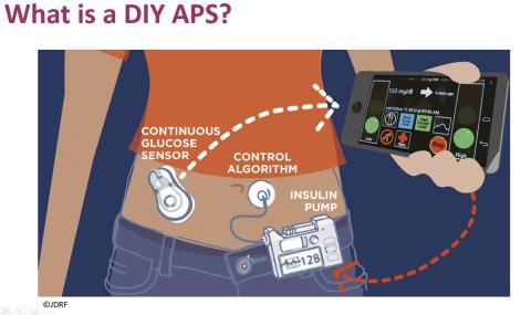 What is DIY APS Image